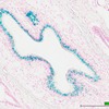 image of vas deferens